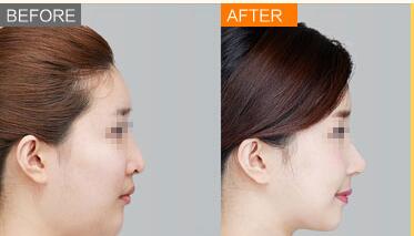 ��¡�����������ʲôλ�ò��ɶ�